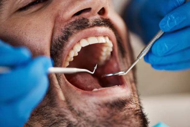 Best Emergency Broken Tooth Repair in Farley, IA