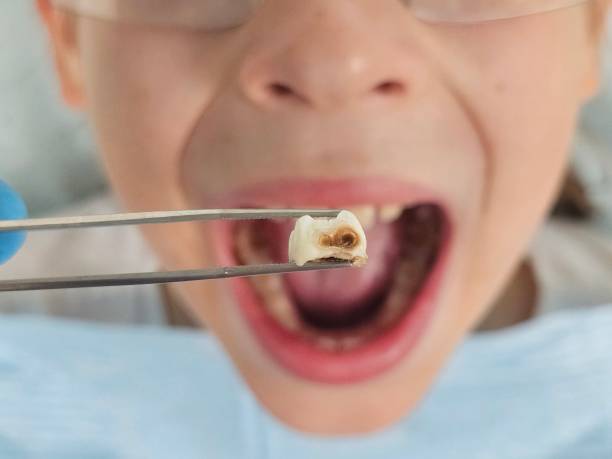 Best Emergency Treatment for Toothache in Farley, IA